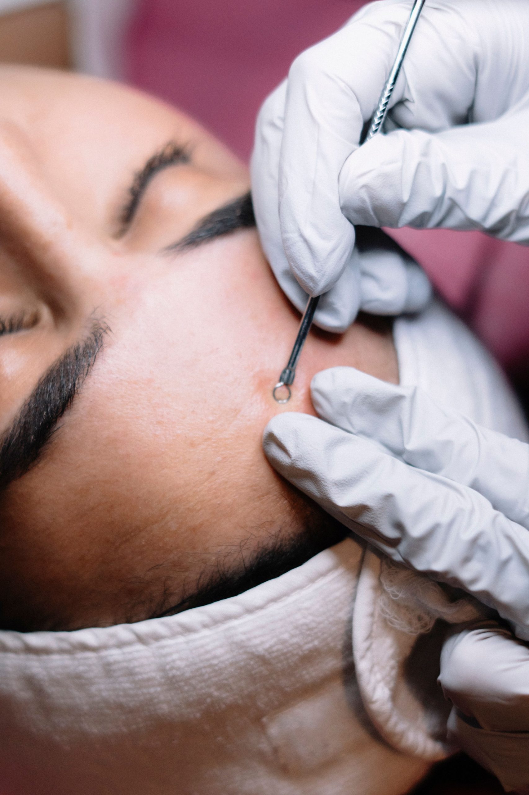 Customized acne facial in Cary, NC with relaxation realm