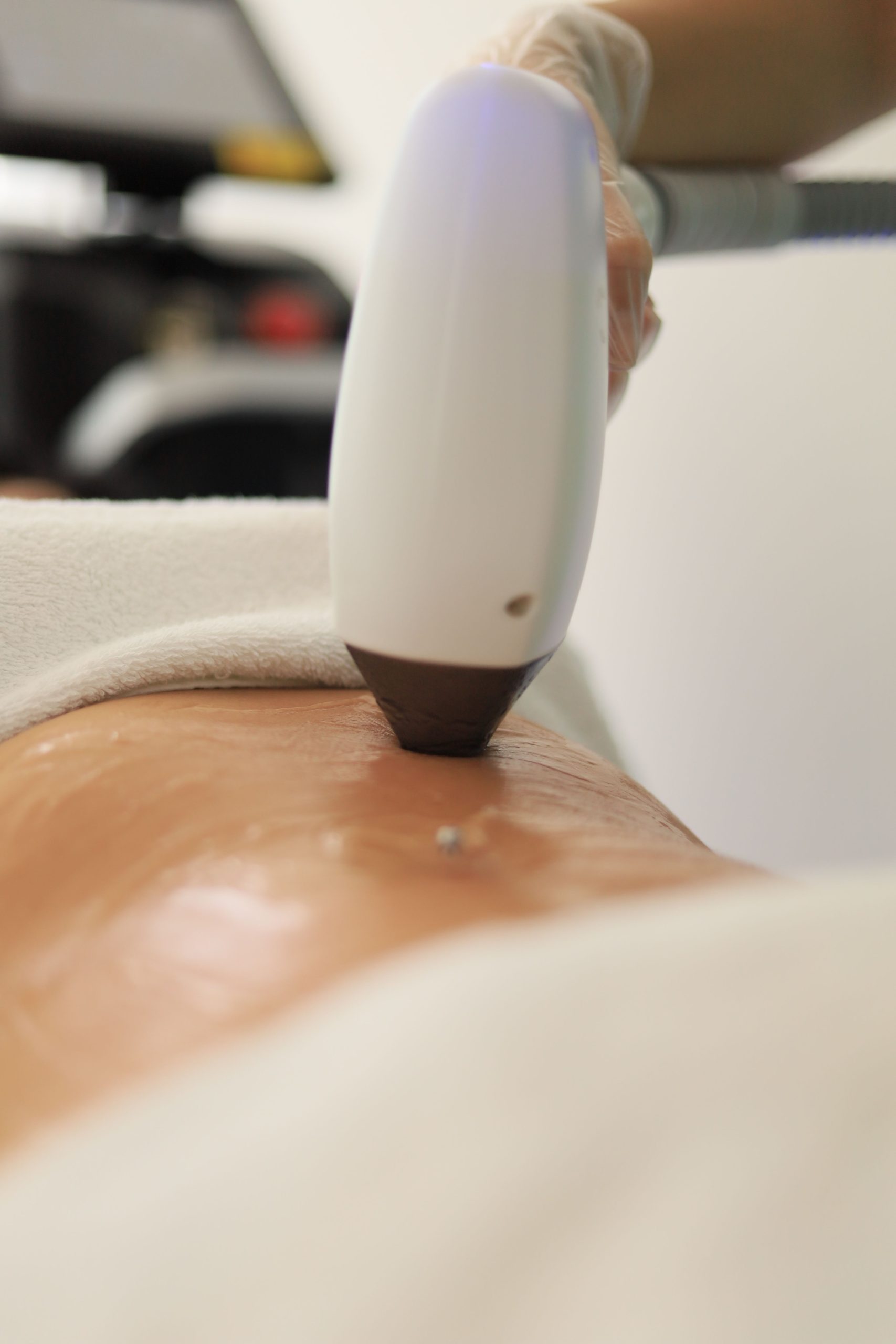 Cavitation by relaxation realm cary nc